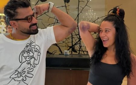 Khatron Ke Khiladi: आशीष के बाद ये हसीना 'KKK 14' में बुरी तरह हुईं घायल, तस्वीर शेयर कर दिखाए जख्म