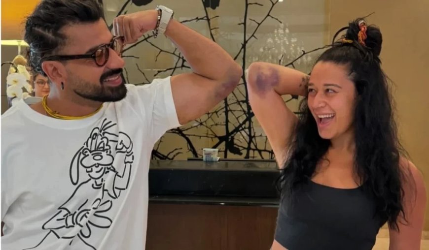 Khatron Ke Khiladi: आशीष के बाद ये हसीना 'KKK 14' में बुरी तरह हुईं घायल, तस्वीर शेयर कर दिखाए जख्म