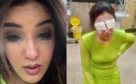 Jasmin Bhasin News: जैस्मिन का दिखना बंद होने से ठीक पहले था ऐसा हाल, रैंप पर चलते हुए लेना पड़ा सहारा, देखें वीडियो