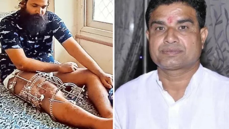 Girraj Singh Malinga: पूर्व-विधायक मलिंगा की जमानत रद्द, करना होगा सरेंडर, AEN-JEN को पीटने का आरोप