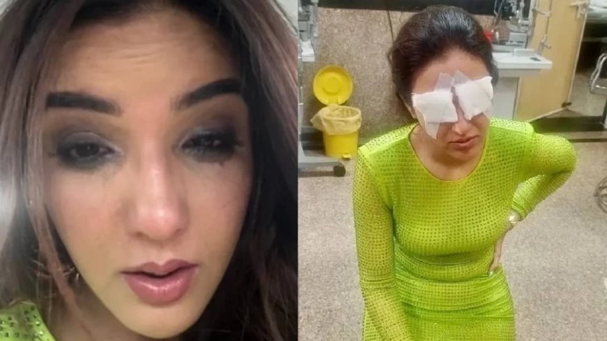 Jasmin Bhasin News: जैस्मिन का दिखना बंद होने से ठीक पहले था ऐसा हाल, रैंप पर चलते हुए लेना पड़ा सहारा, देखें वीडियो