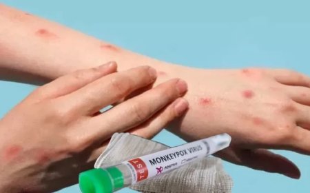 Mpox Case in Kerala: मंकीपॉक्स का देश में दूसरा केस मिला, क्या खतरनाक बन रहा है ये वायरस?