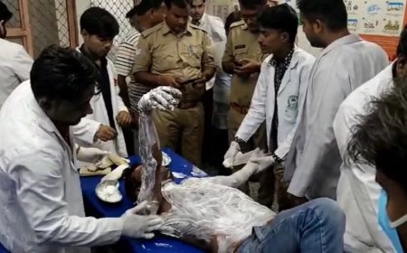 UP Vidhan Sabha: UP विधानसभा के सामने शख्स ने खुद को लगाई आग, मच गया हड़कंप