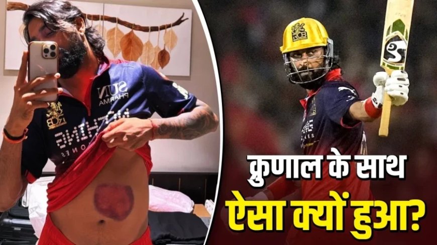 Krunal Pandya: चोट के बावजूद 73 रनों की तूफानी पारी, फिर भी छिना प्लेयर ऑफ द मैच का हक?