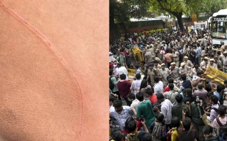 जंतर मंतर पर प्रदर्शन के दौरान CAPF जवान पर चाकू से हमला, NSUI कार्यकर्ता पर आरोप