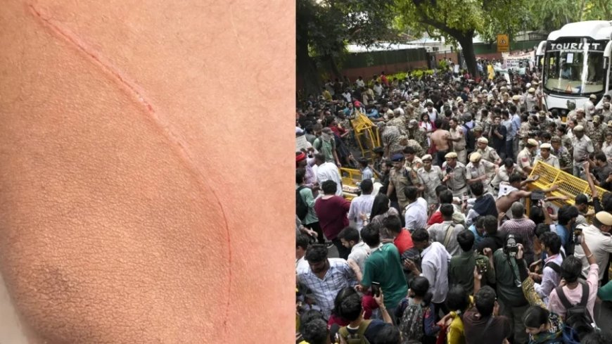 जंतर मंतर पर प्रदर्शन के दौरान CAPF जवान पर चाकू से हमला, NSUI कार्यकर्ता पर आरोप